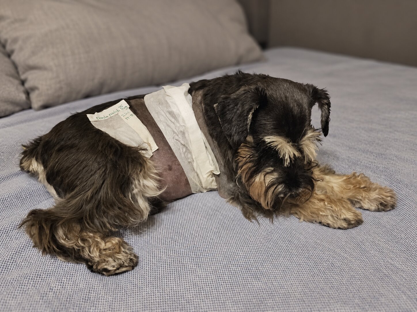Senya recovering at home after a second, wider surgery for a soft tissue sarcoma